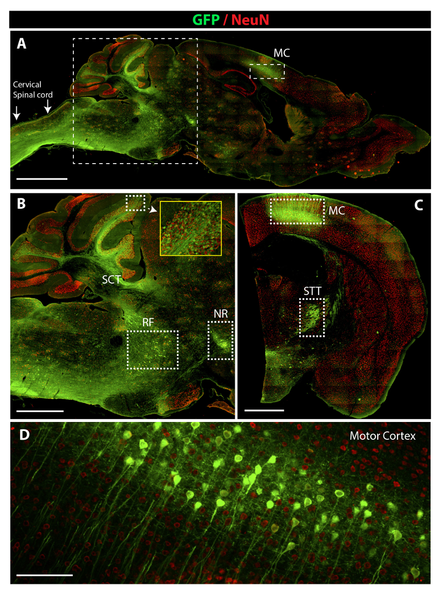 Subpial Injection Subpial Adeno-associated Virus 9 (AAV9) Vector Delivery in Adult Mice ...